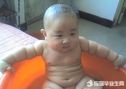 肥胖对儿童有什么心理影响?